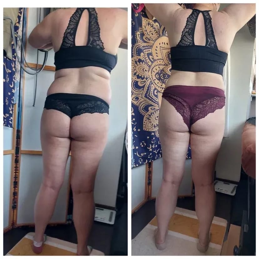 Антицеллюлитный массаж и шугаринг: идеальное тело и гладкая кожа.