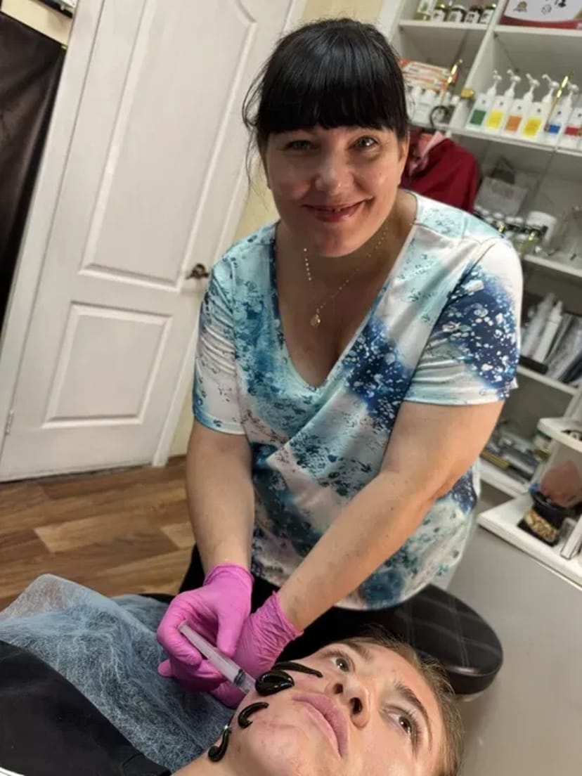 Обучение хиджама массаж гирудотерапия 500$