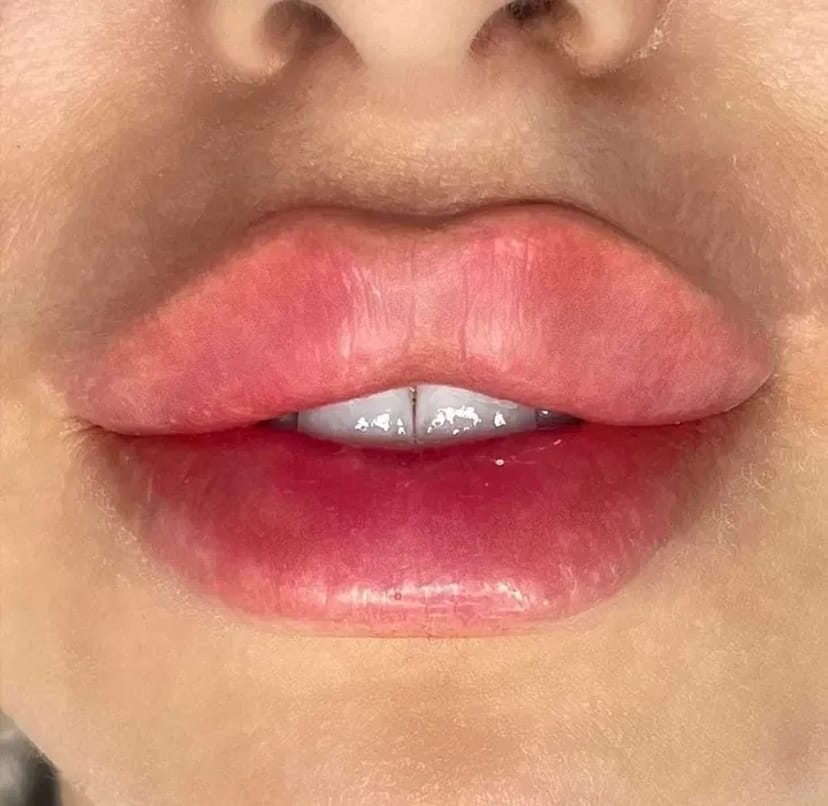 Акція! -30%! Збільшення губ у техніці плоский бант.