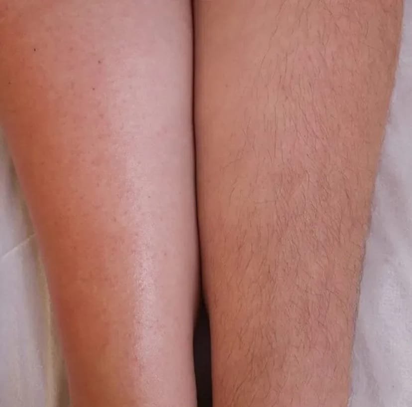 Шугаринг, воск! Троещина! Работаю профессиональными материалами