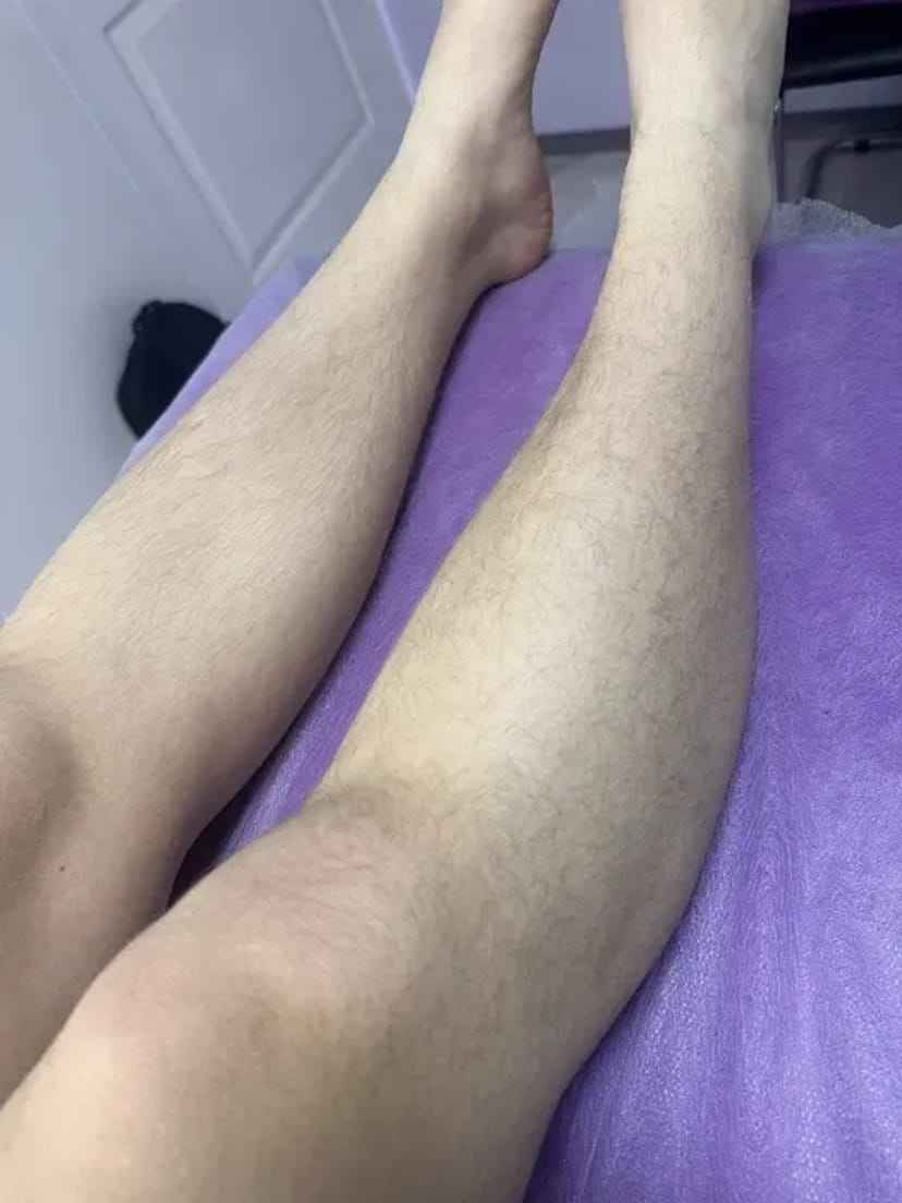 Шугаринг Перемога 6: Ідеально Гладка Шкіра Всього за 300 грн!