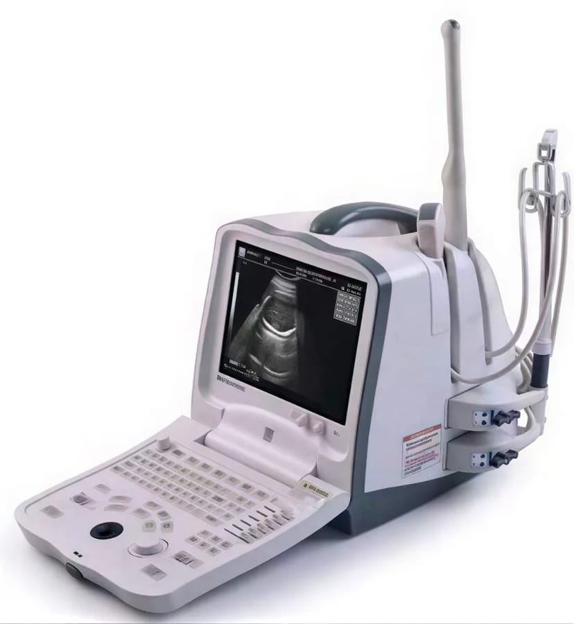 Mindray DP-6600 портативний УЗД апарат для діагностики
