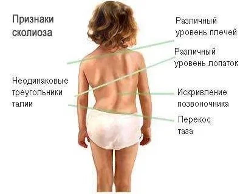 Лікування сколіозу, вальгусу, клишоногості, плоскостопості, порожнистої стопи.