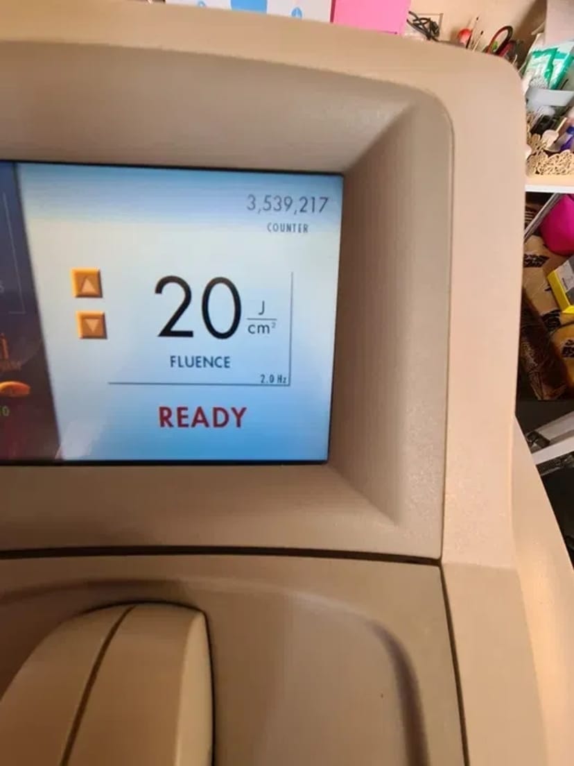 Діодний лазер