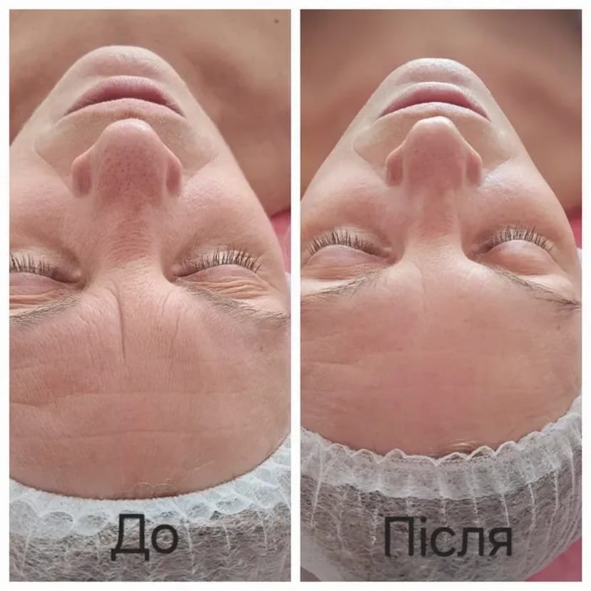 Косметолог. Массаж обличчя. Чистка обличчя. Пілінги.