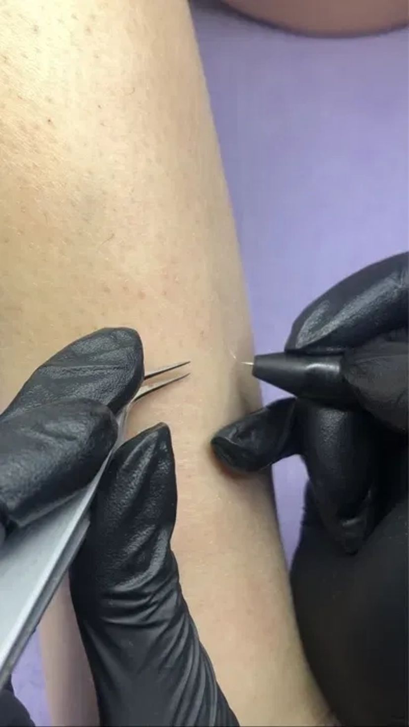 Навчання електроепіляції