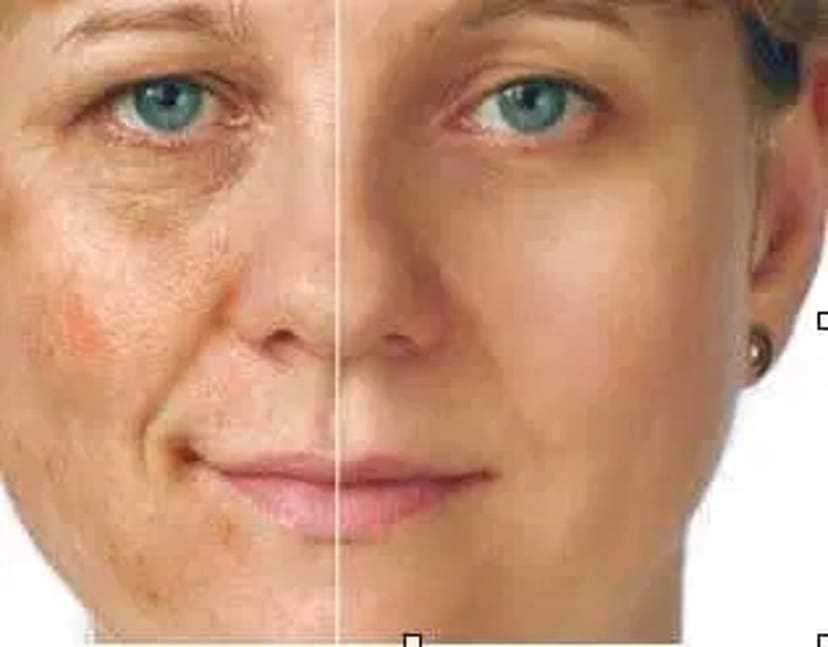 Хіджама для обличчя. Краса та догляд