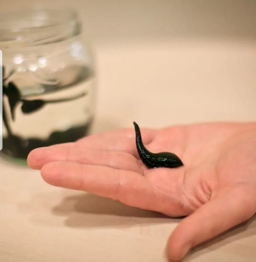 Капілярне кровопускання/Хіджама 