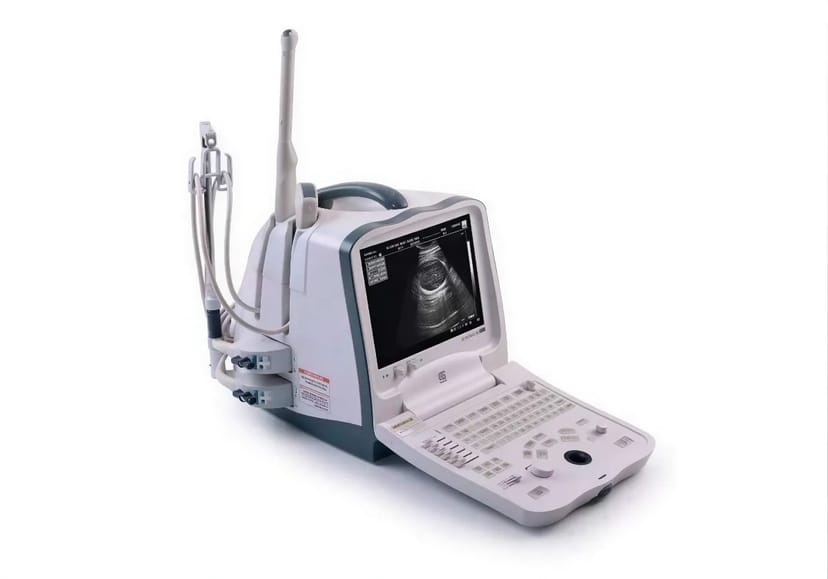 Професійний апарат УЗД Mindray DP-6600 - апарат для обстеження